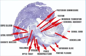 Dolphin Brain Structure And Functions